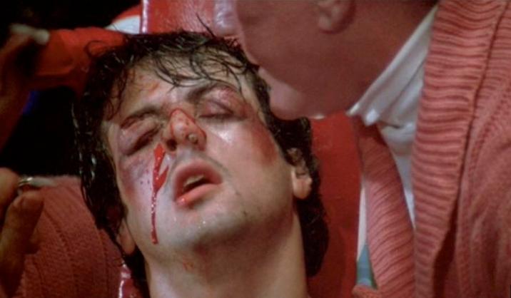 Sep 2025: Julian Knight’s broken nose bashed in 1987 whilst serving at Duntroon – to be finally fixed after 38 years!