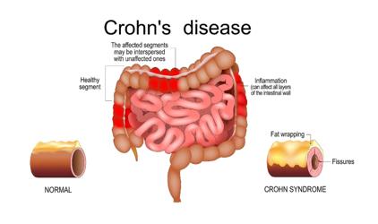 Oct 2025: Julian Knight is seriously incapacitated